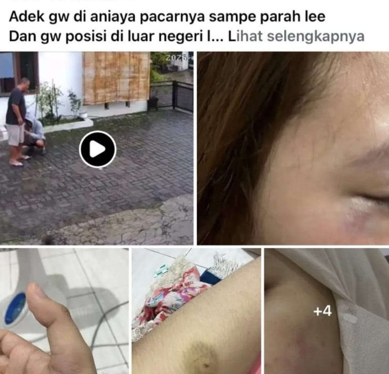 Buntut Dugaan Kekerasan Mahasiswanya UNISA Jogja Sampaikan Ini