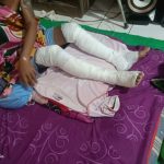 Buat Perapian di Sekitar Kandang Berujung Musibah, WY (30) Alami Luka Bakar di Kedua Kaki