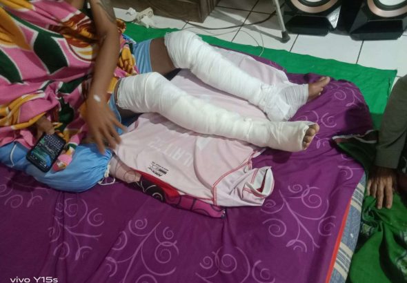 Buat Perapian di Sekitar Kandang Berujung Musibah, WY (30) Alami Luka Bakar di Kedua Kaki