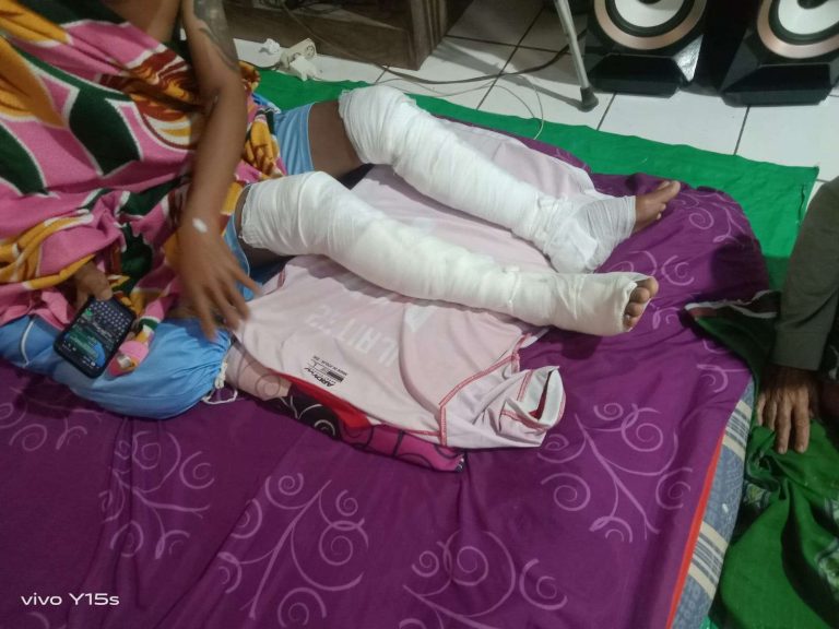 Buat Perapian di Sekitar Kandang Berujung Musibah, WY (30) Alami Luka Bakar di Kedua Kaki