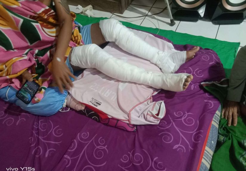 Buat Perapian di Sekitar Kandang Berujung Musibah, WY (30) Alami Luka Bakar di Kedua Kaki
